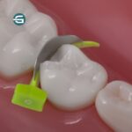 وج فندرمیت پرایم دایرکتا-3