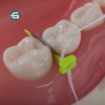 وج فندرمیت پرایم دایرکتا-4