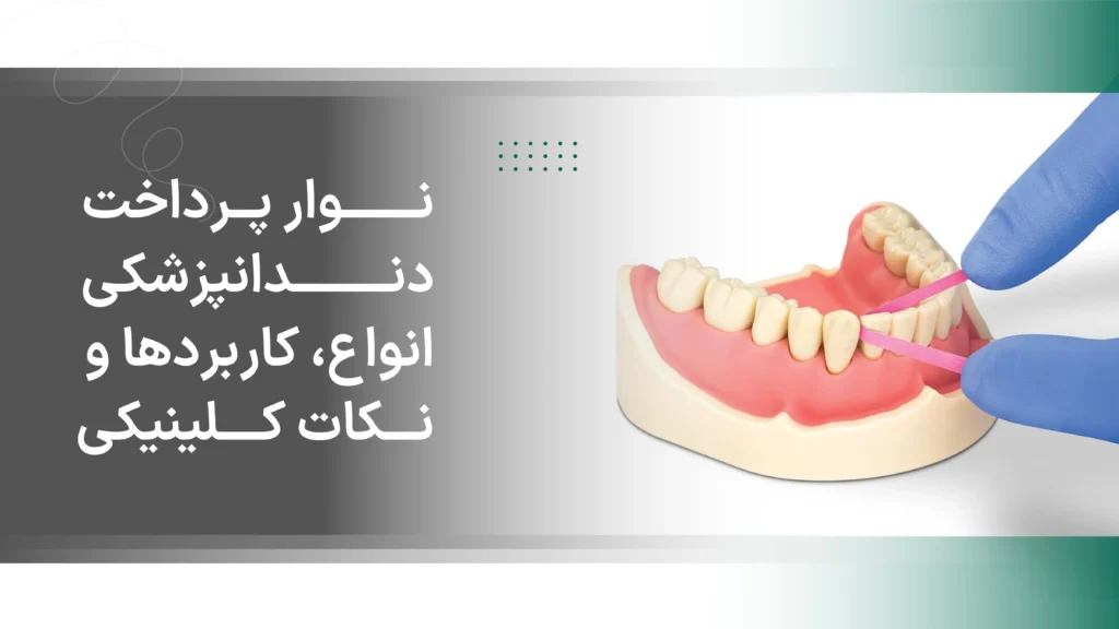 نوار پرداخت دندانپزشکی: انواع، کاربردها و نکات کلینیکی