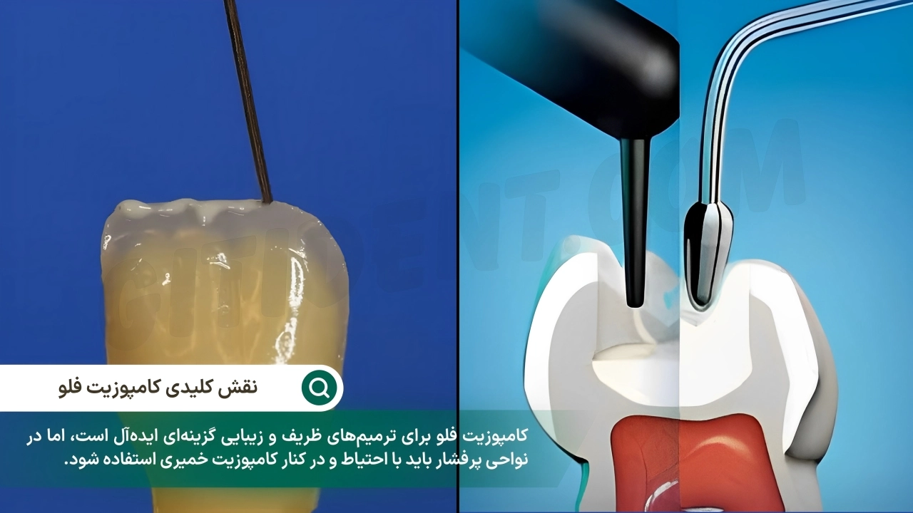 نقش کلیدی کامپوزیت فلو