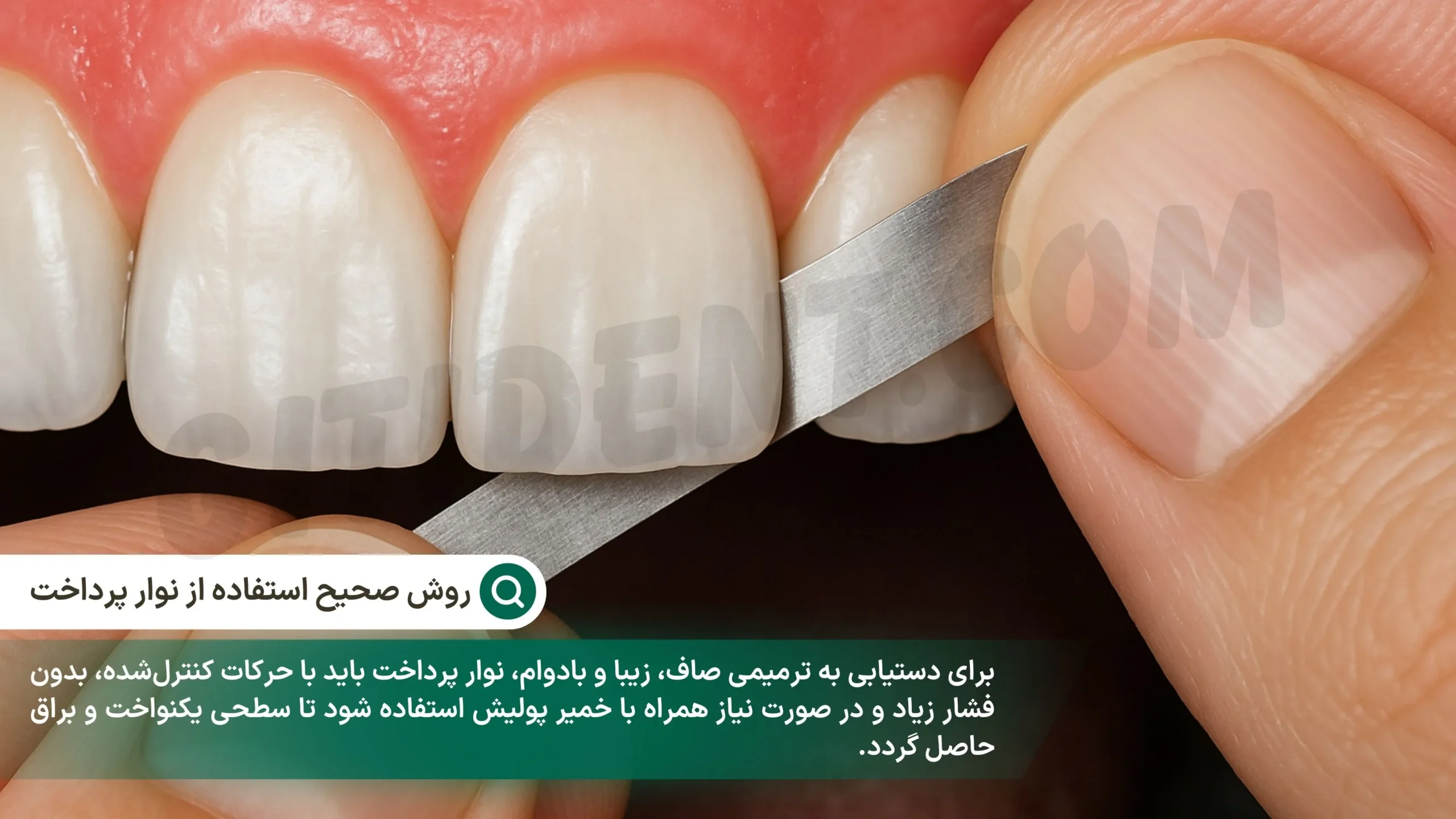 روش صحیح استفاده از نوار پرداخت