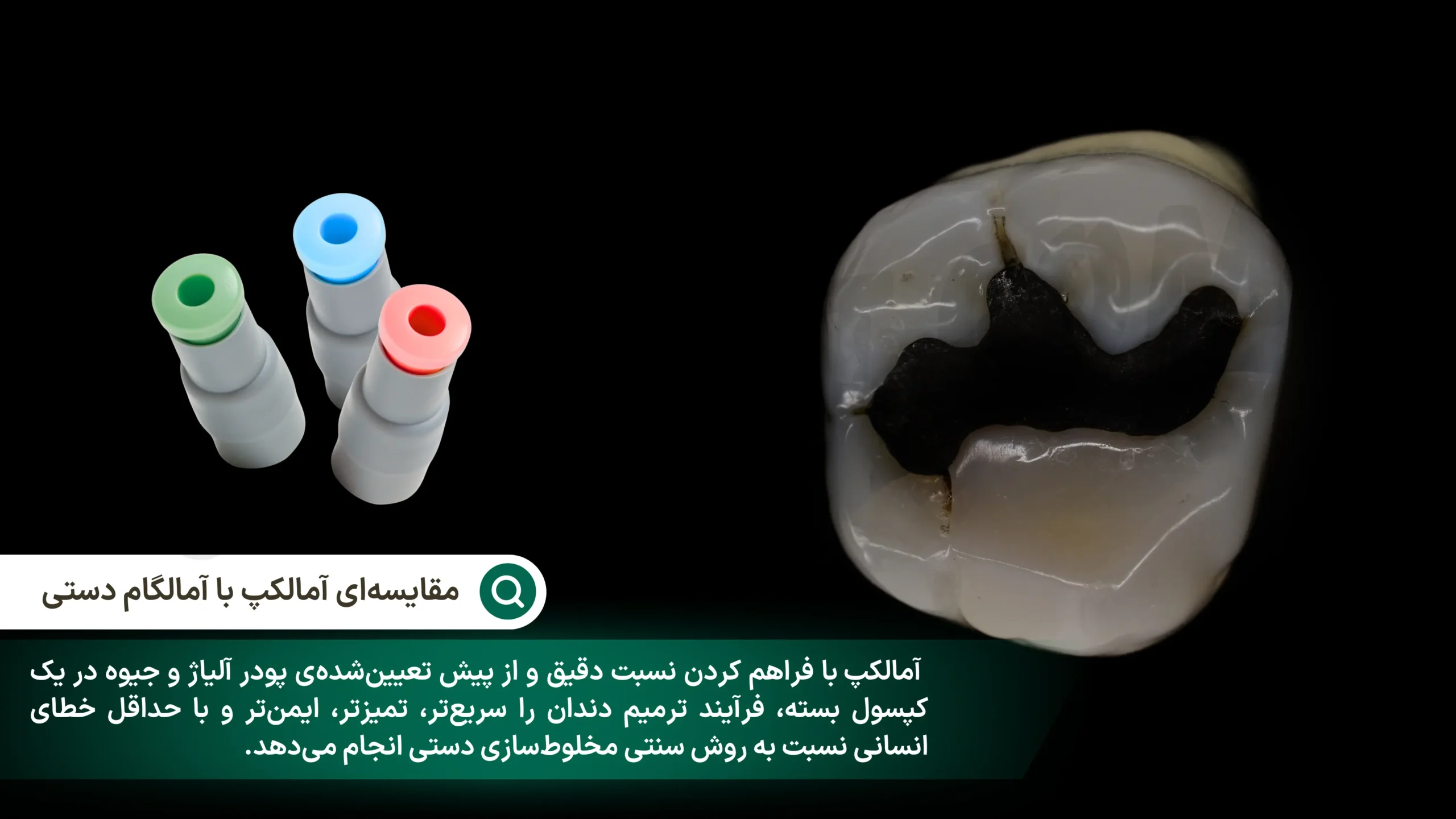 ترمیم دندان با آمالکپ - تفاوت آمالگام و آمالکپ